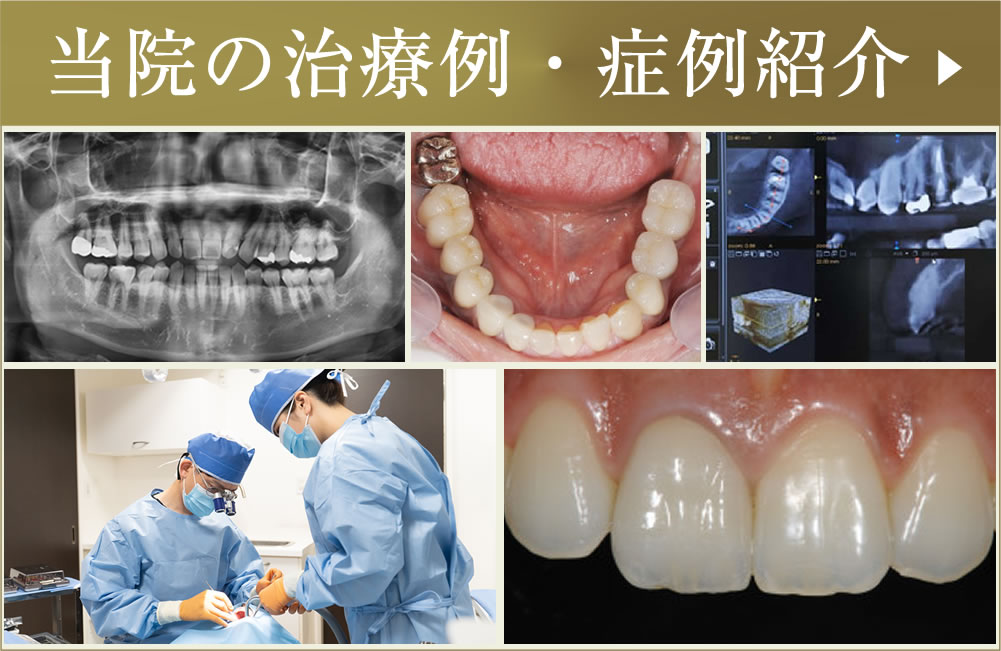 症例・治療例