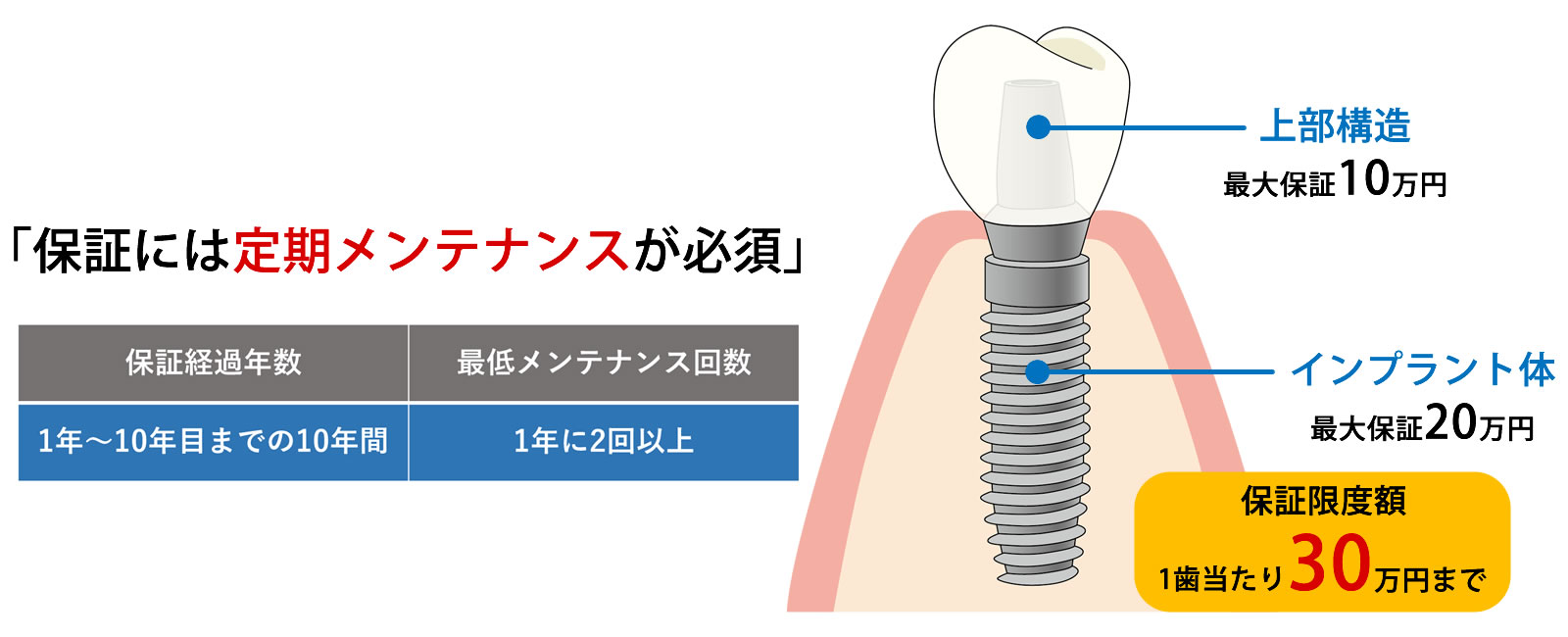 インプラント保証