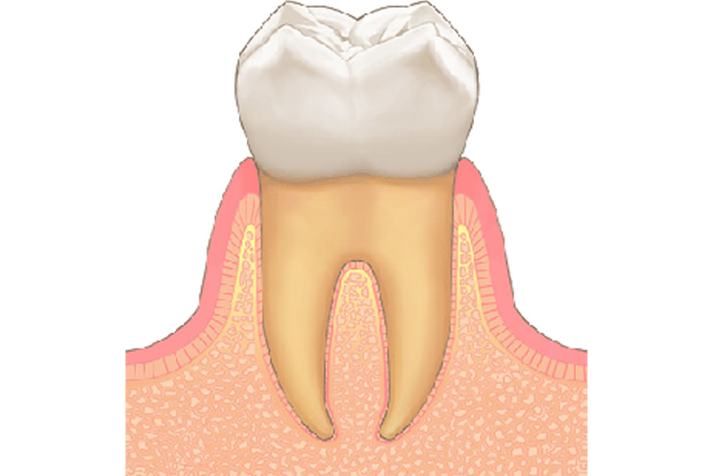 正常な歯周組織
