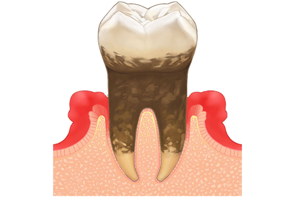 口腔ケア・歯周病治療など